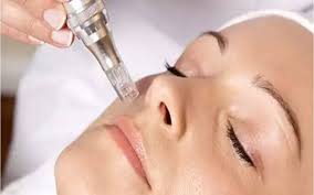 dermapen